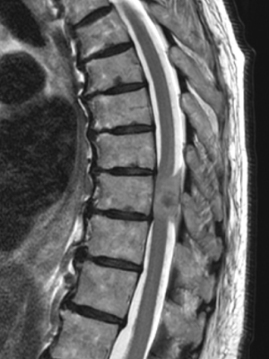 MR_MRI 63225 - SPINE_SAG T2 TX_2025-05-12 (1)